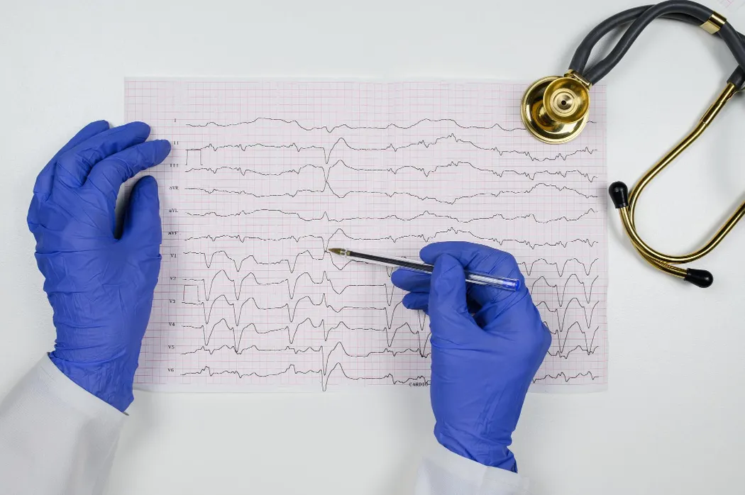 Holter EKG – precyzyjna diagnostyka bez bólu i stresu